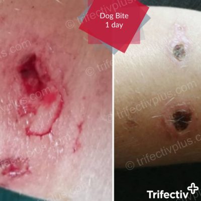 Dog bite after 1 day